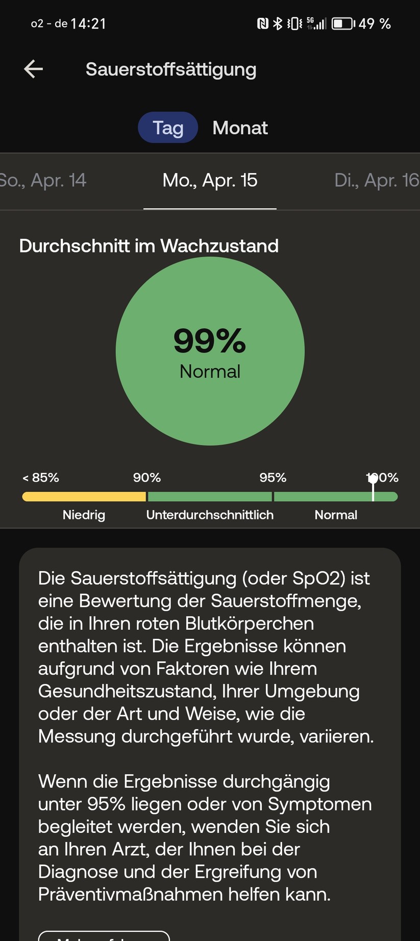 Withings Scanwatch Nova - App