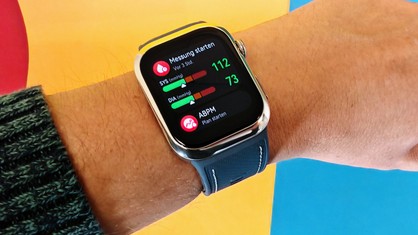 Top 10: Die beste Smartwatch mit EKG im Test – Testsieger misst