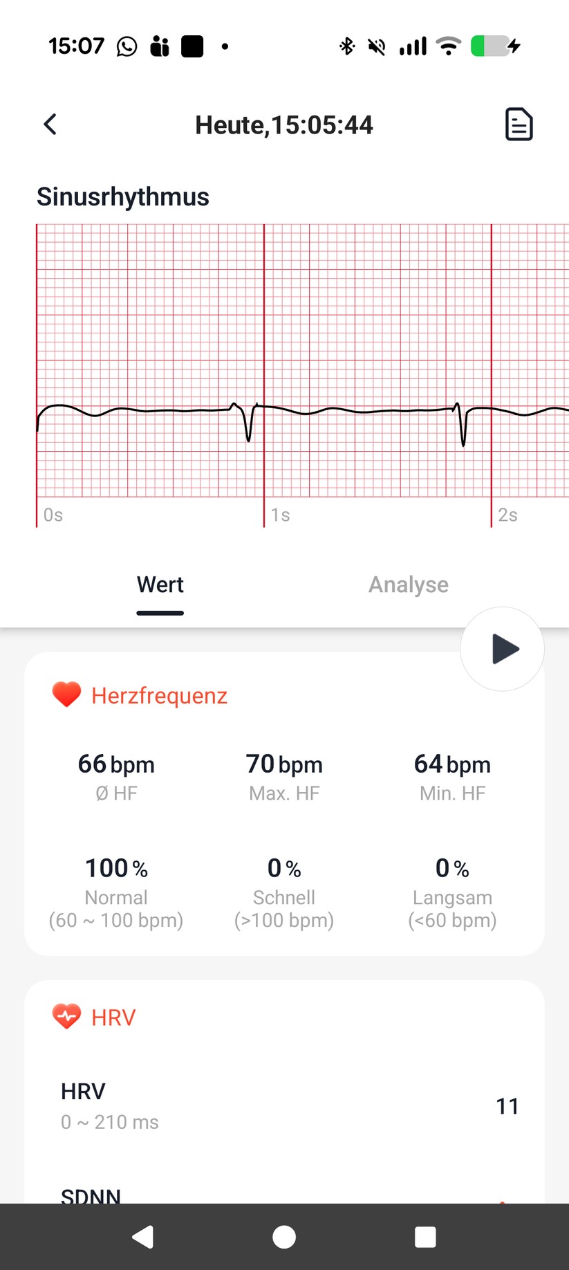  EKG in G-Band-App