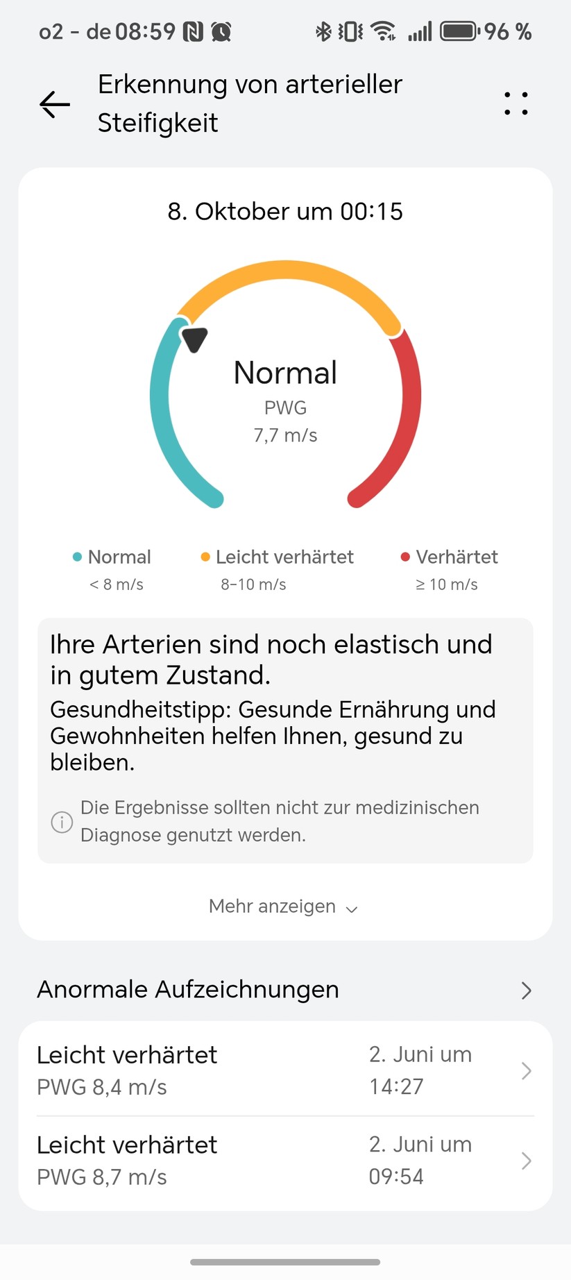 Huawei Watch Ultimate 2 - Health App