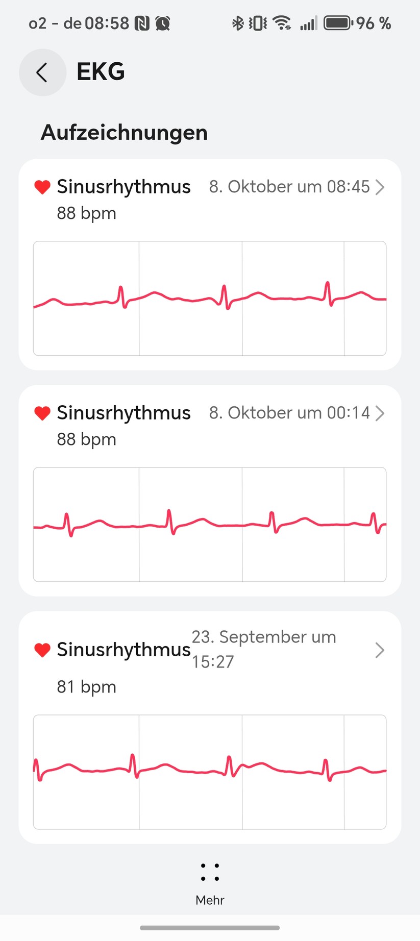 Huawei Watch Ultimate 2 - Health App