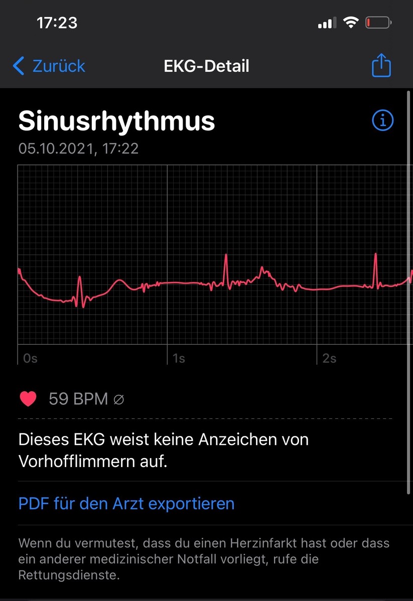 Apple Watch 7: App, Konfiguration und Features