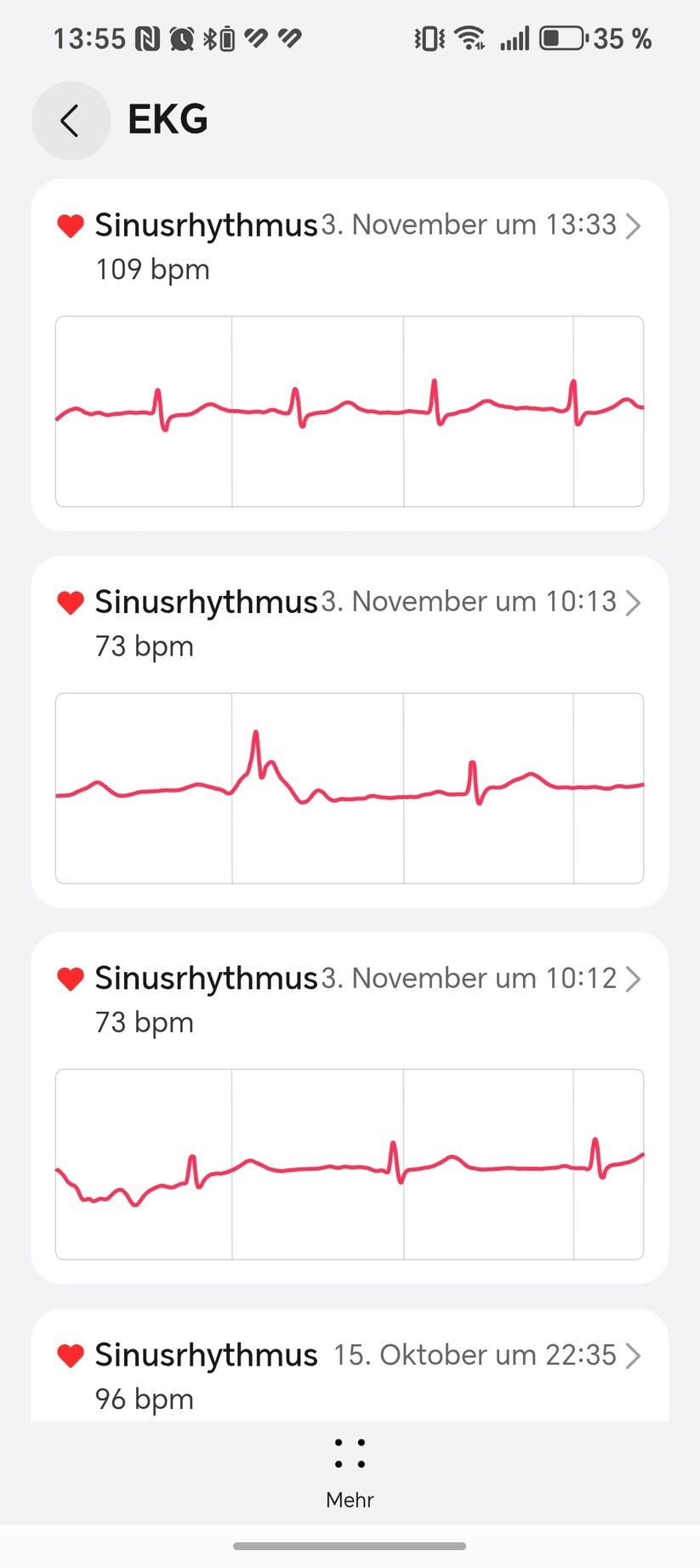 Huawei Watch D2 - Health App 