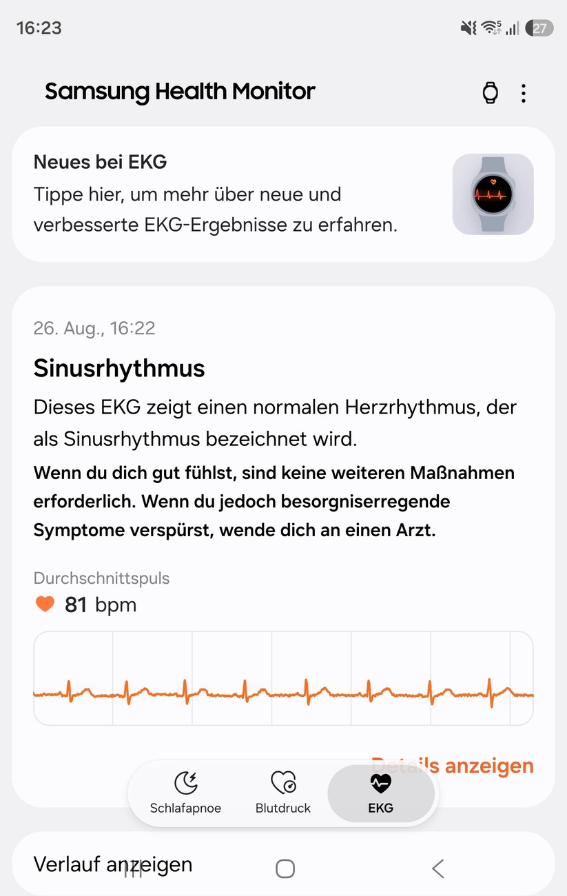 Samsung Galaxy Watch Ultra 2: EKG via Health Monitor