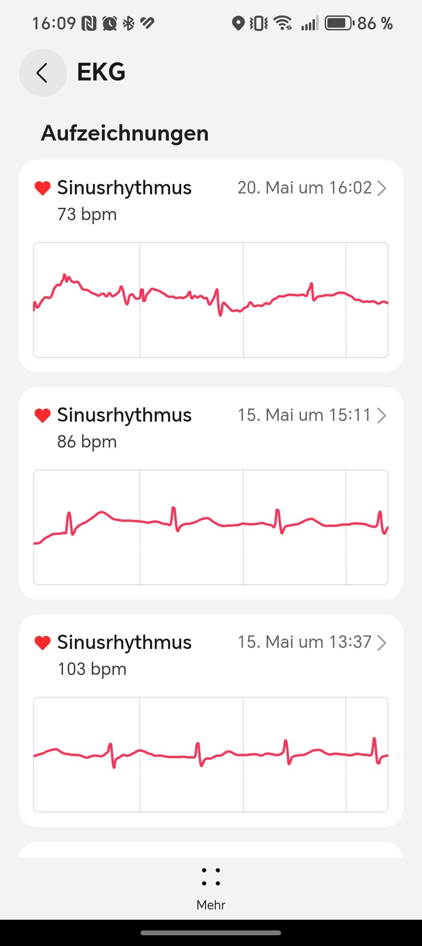 Huawei Watch 5 - Health App
