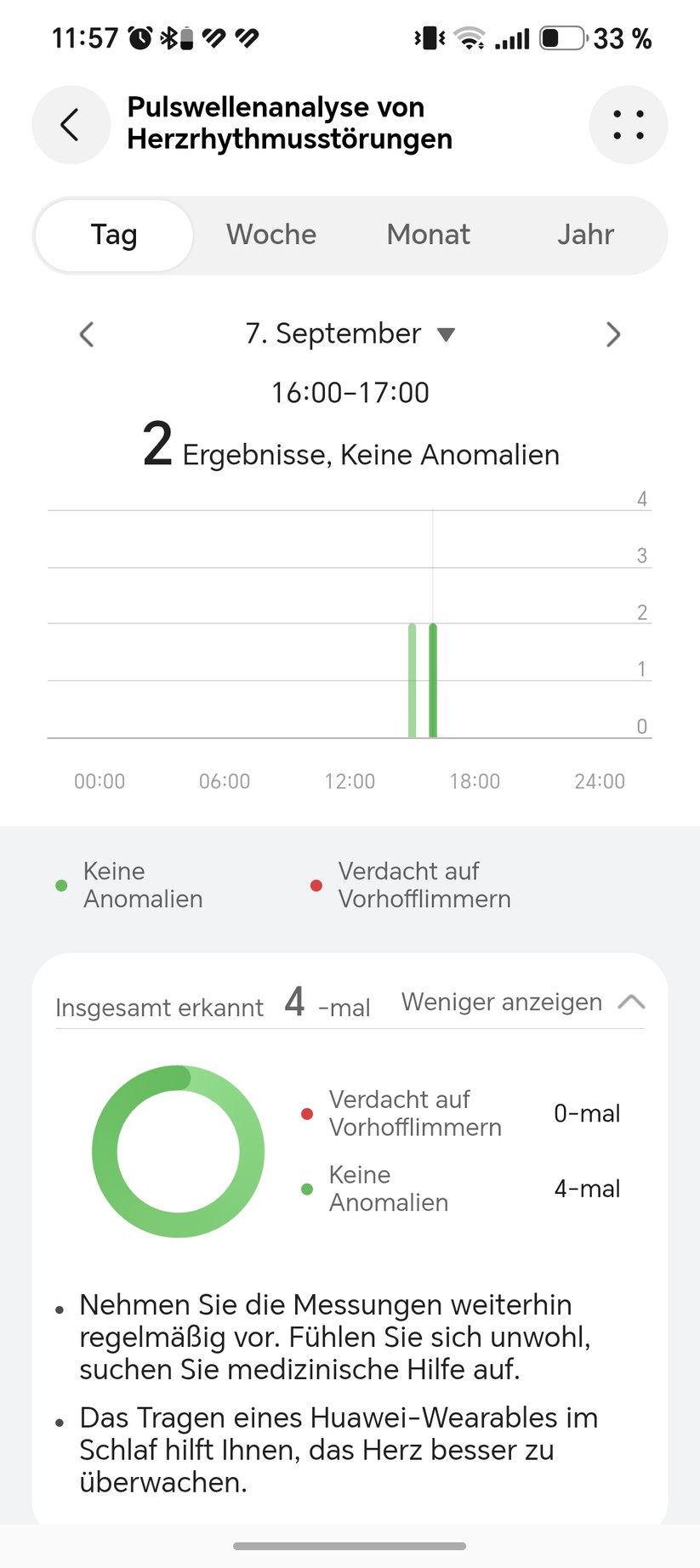 Huawei Watch GT 7: Health App