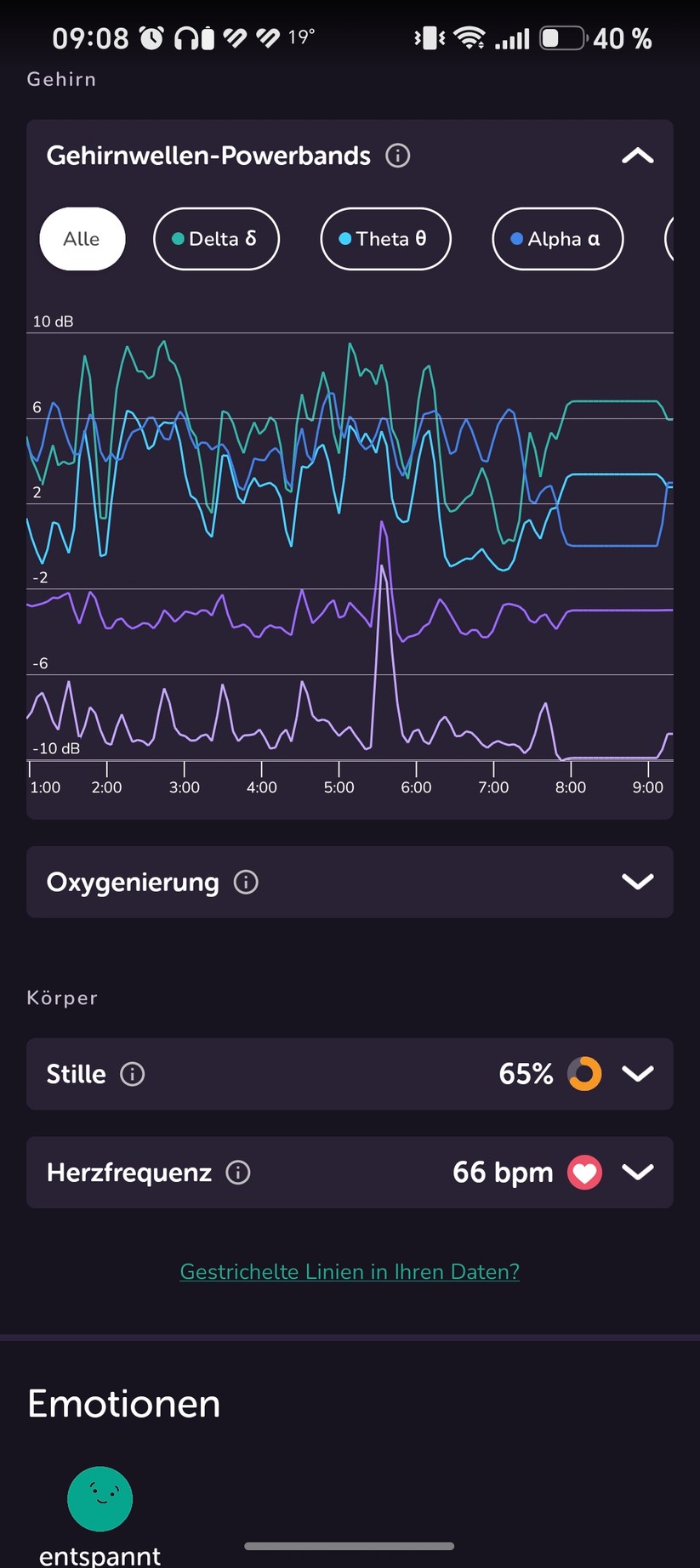 Muse S Athena: Analyse