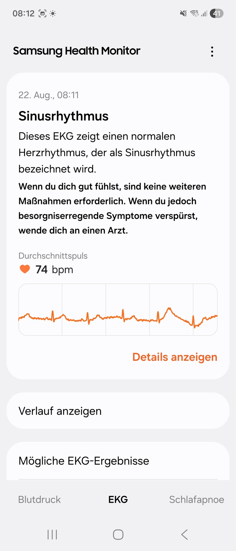 Samsung Galaxy Watch 8 Classic: Samsung Health Monitor