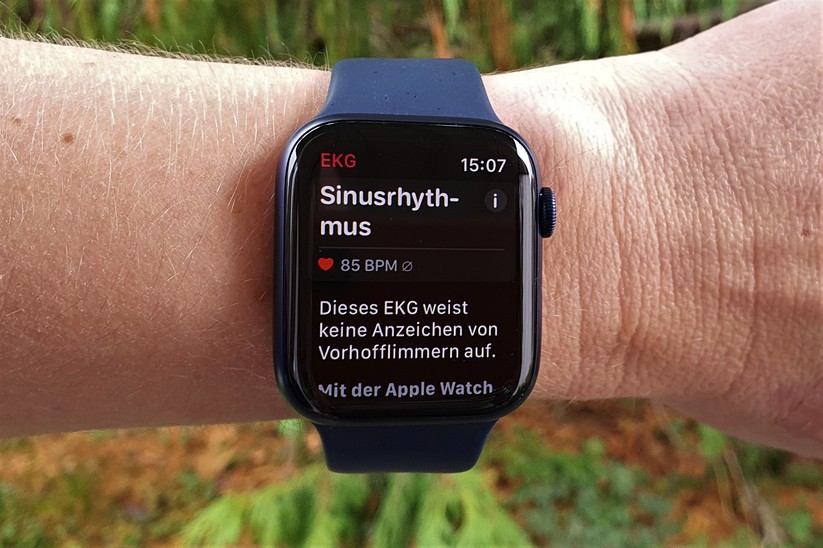 Legt man den Zeigefinger auf die Krone, schreibt die Apple Watch ein EKG.