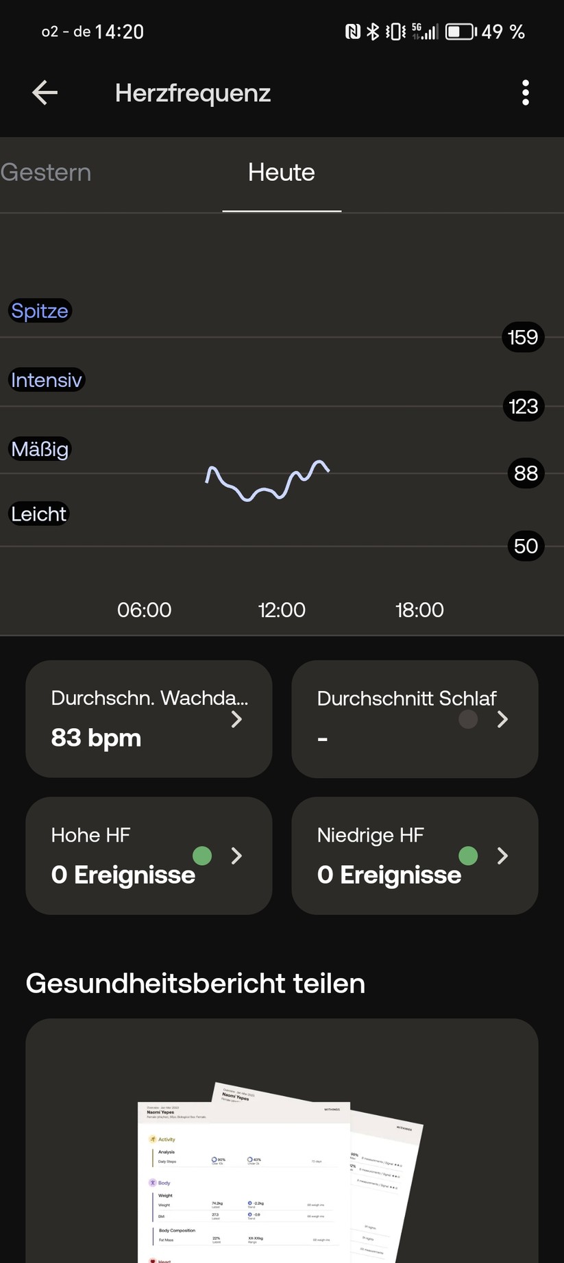 Withings Scanwatch Nova - App