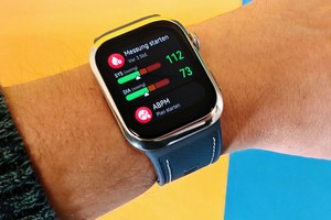  Diese Smartwatch misst Blutdruck und EKG